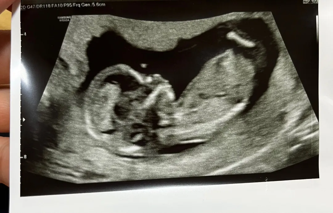 12주 6일차인데 성별 알수 있나요?^^;;