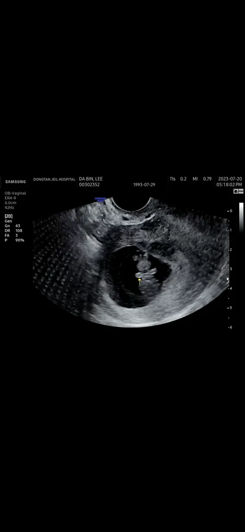 9주 1일 튼튼이👶🏻