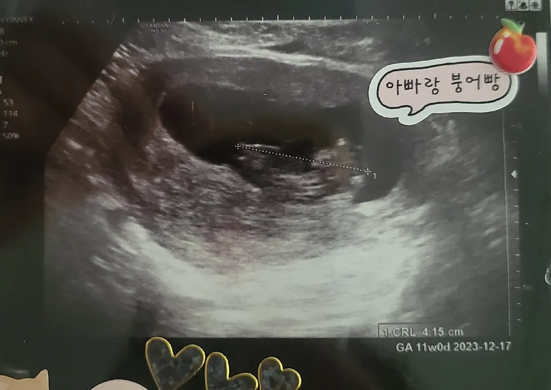 저도각도법참견좀부탁드려봐요