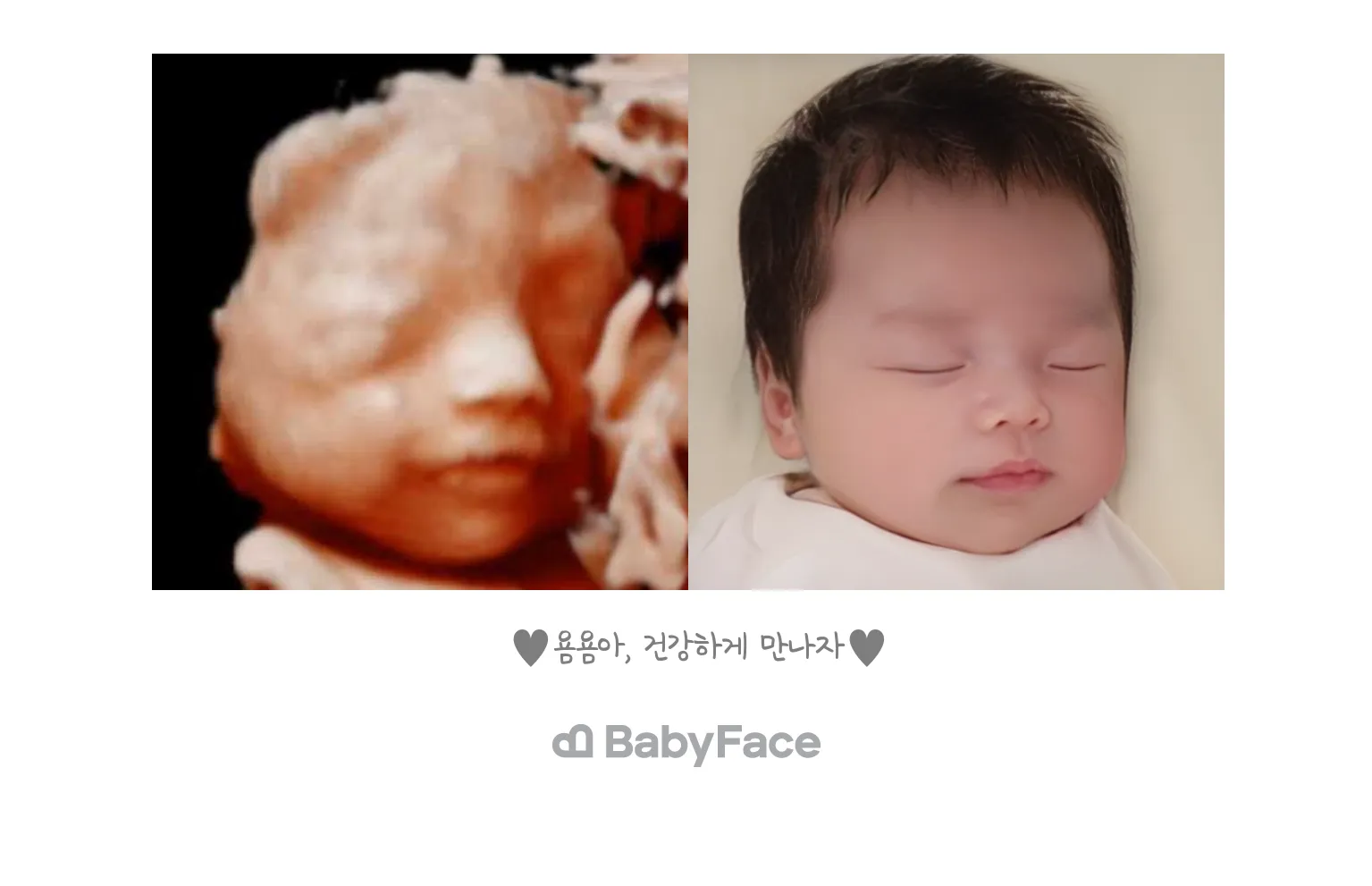 베이비페이스 했어요!