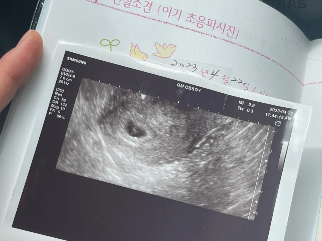 난황 맞나요..? 확인 부탁드려요