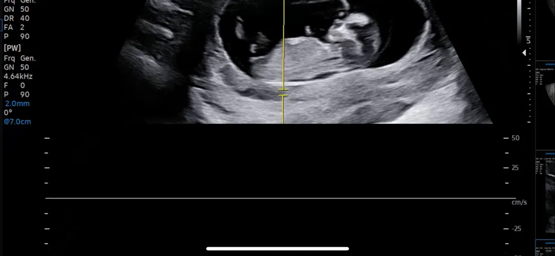11주 3일 각도법 봐주실분