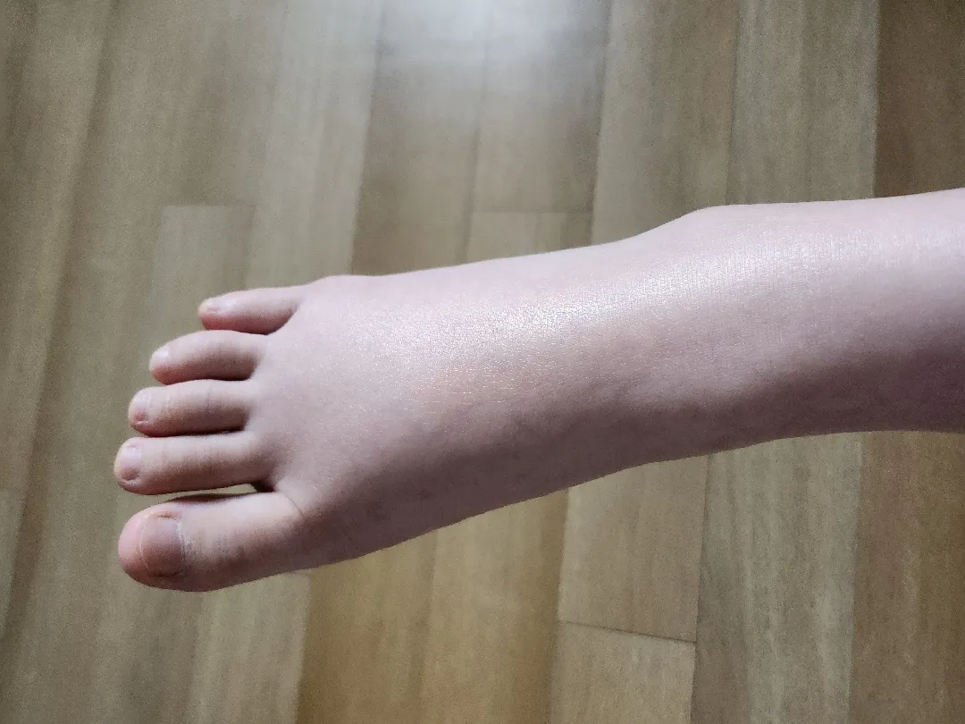 붓기 빼는 노하우 있으신가여...ㅠ