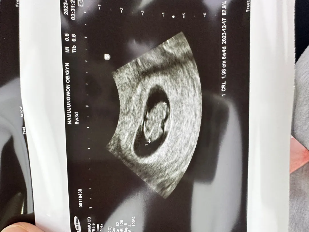 젤리곰 보구 왔어영