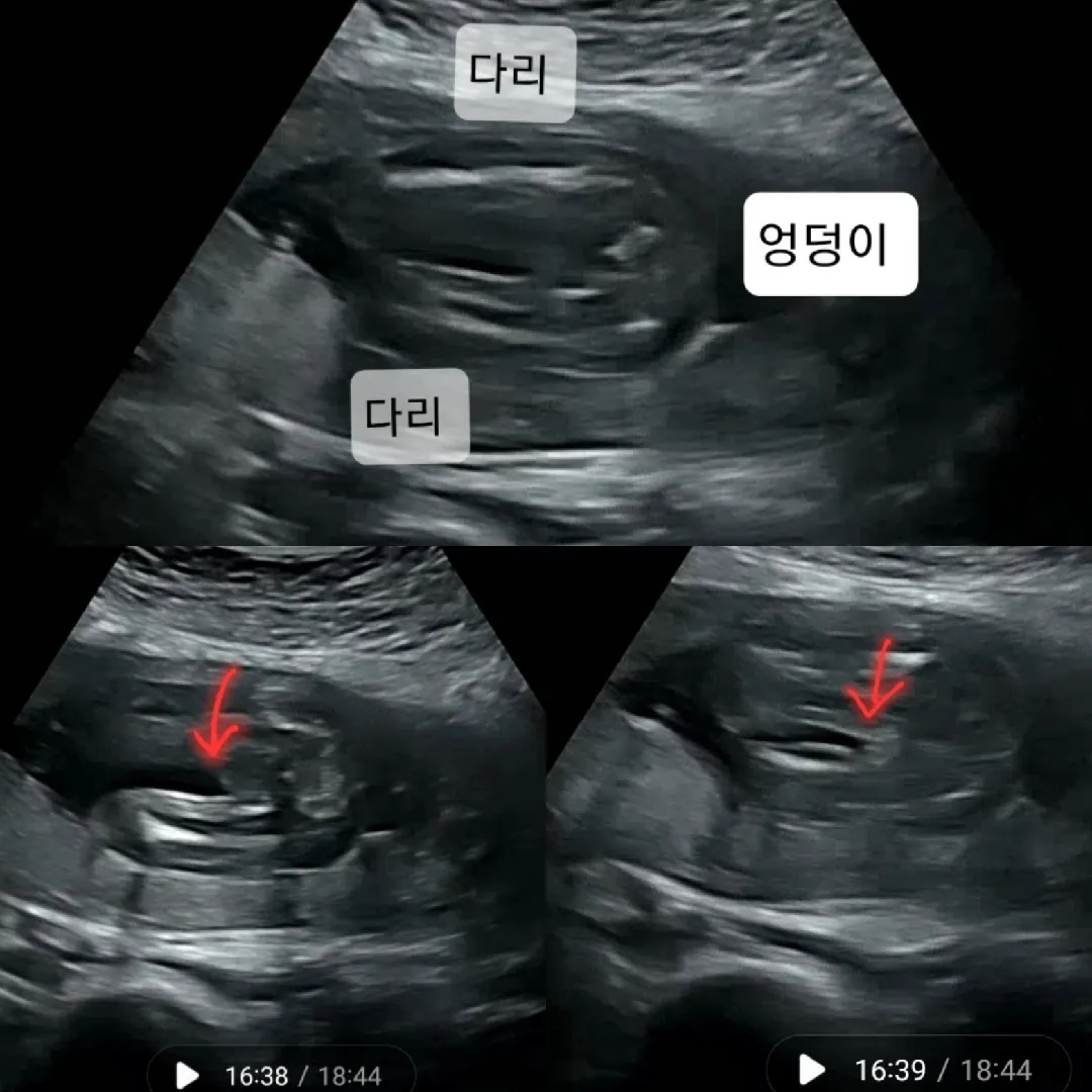 19주2일차 성별 한번 봐주세요🙏