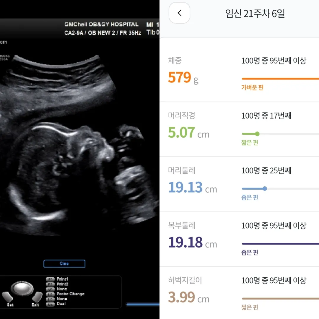 정밀초음파 보고 한참 웃었네요🤭