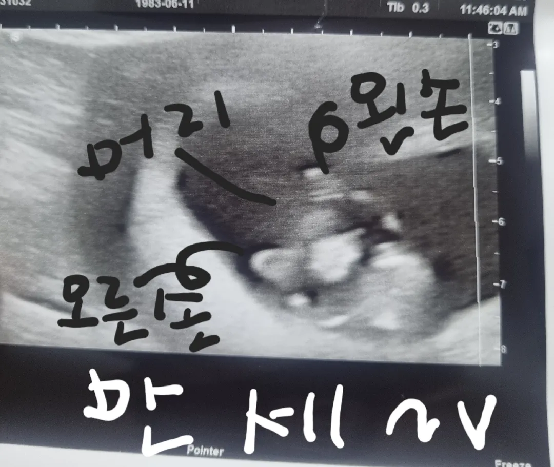 11주시작~