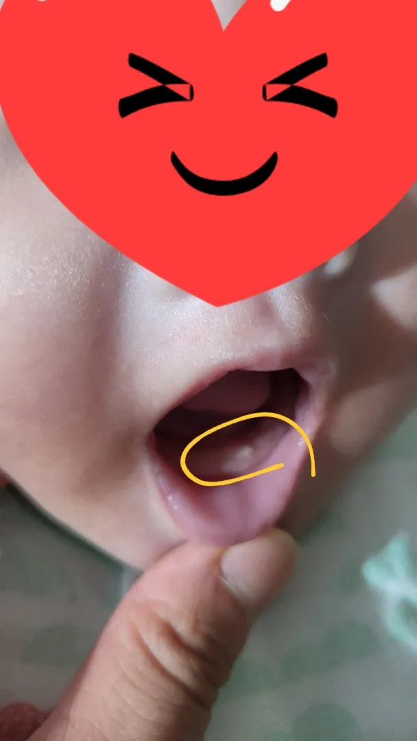 아기 이 나는 시기가 아닌거 같은데 ㅜ