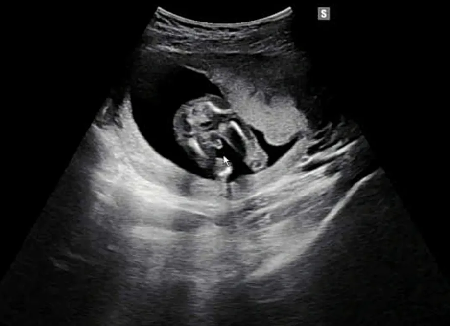 성별반전!!!