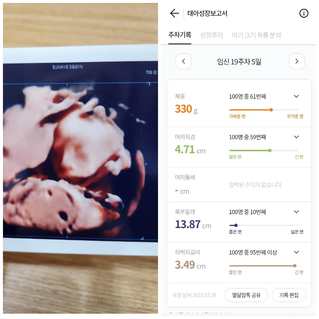 내일은 20주 0일차! 벌써 +6kg네요...ㅎㅎ
