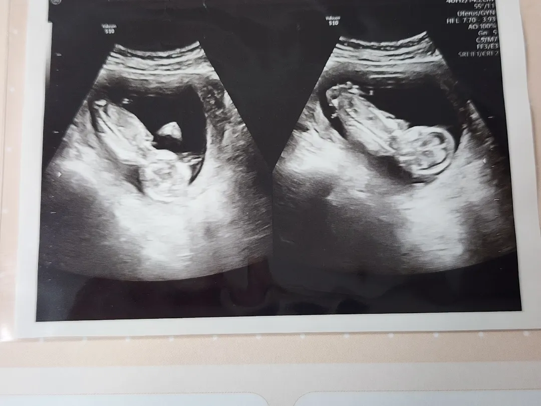 13주5일 알수있나요?
