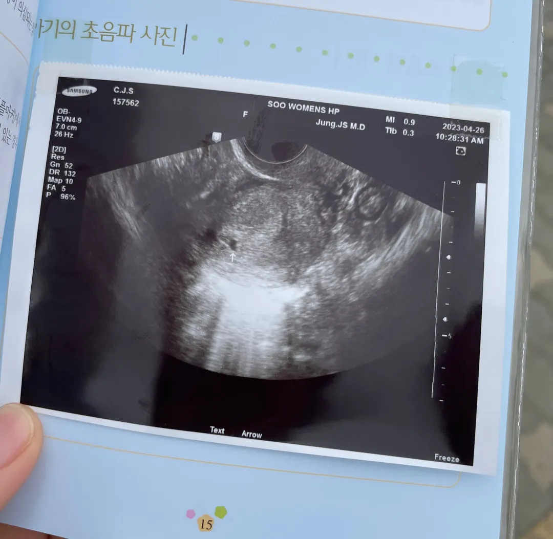 아기집 맞을까요??