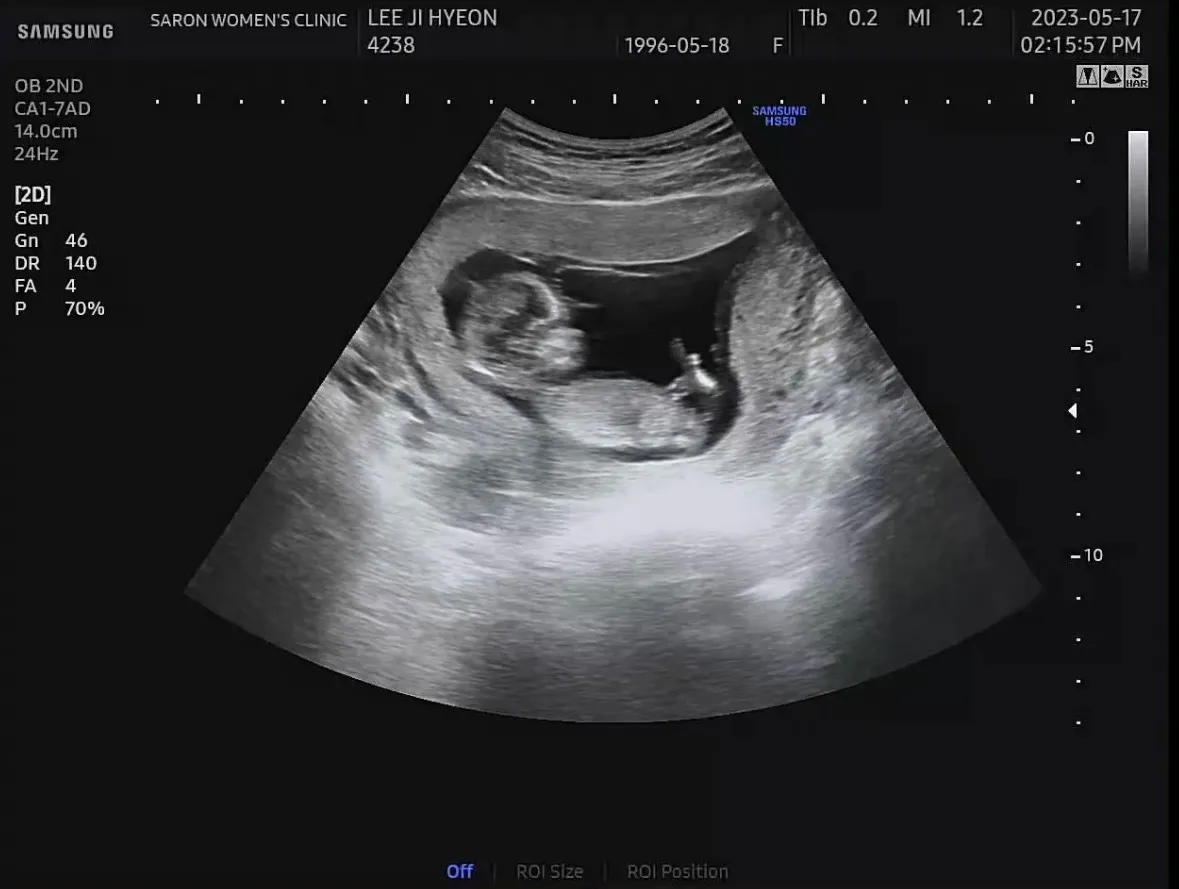 community post image