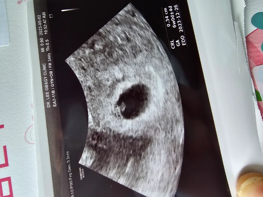 6주0일 방울이♡
