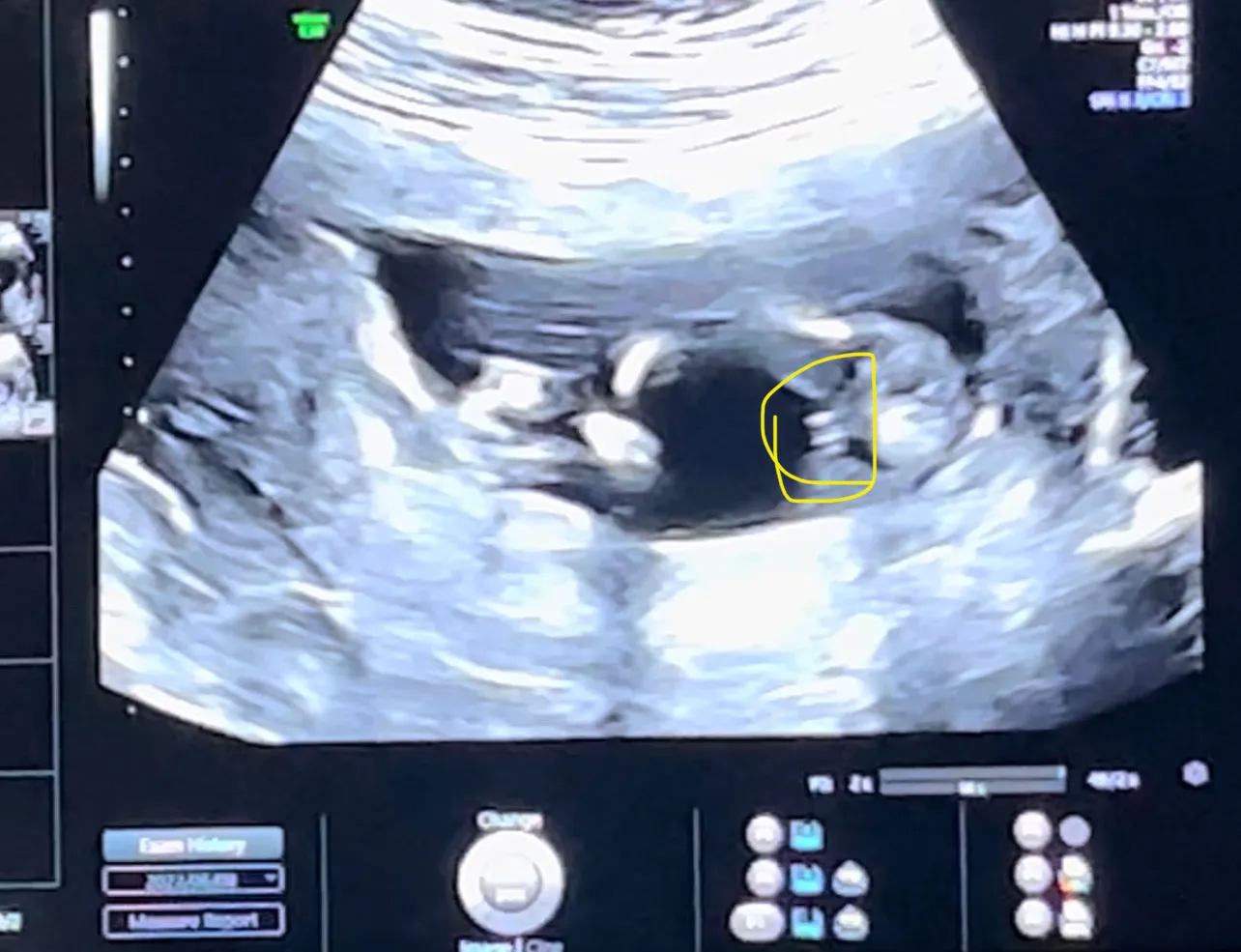 14주 대음순일까용?