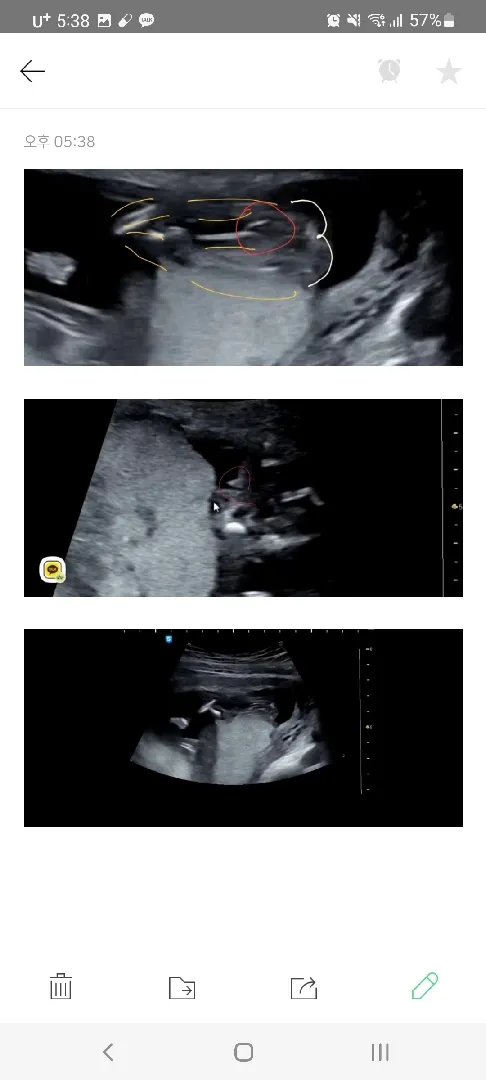 16주 1일여전히 자세가 안좋네여 의견구해봅니다