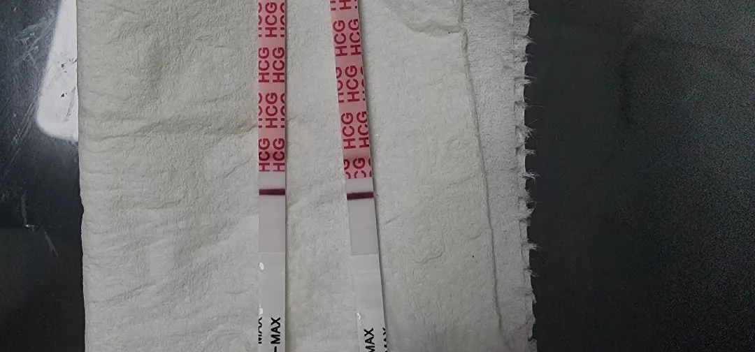 소파술 45일차 배란 예상 10일차....