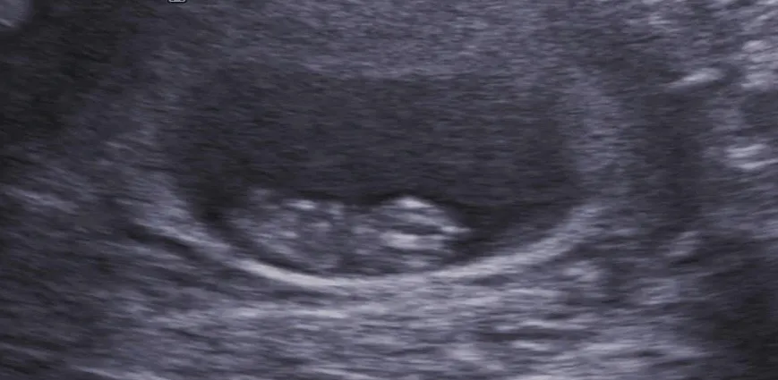 8주 6일차 애기보고왔어요
