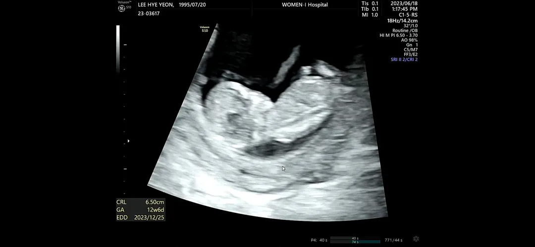 12주 6일 각도법 한번 봐주세유~
