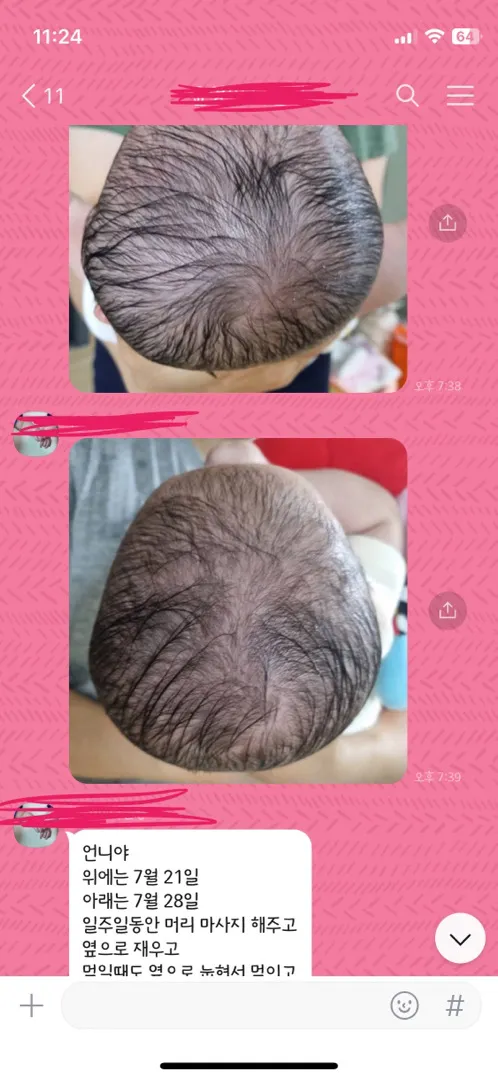 사두 단두로 고민중인 1인 ㅠ (밑에 미친시누이글 읽다가 정보 공유합니다)