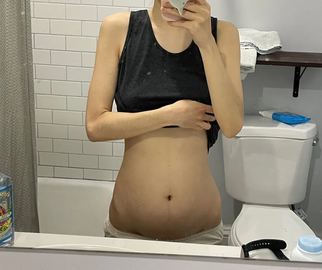 11주 2일 배 다들 어느정도 나오셨어요?
