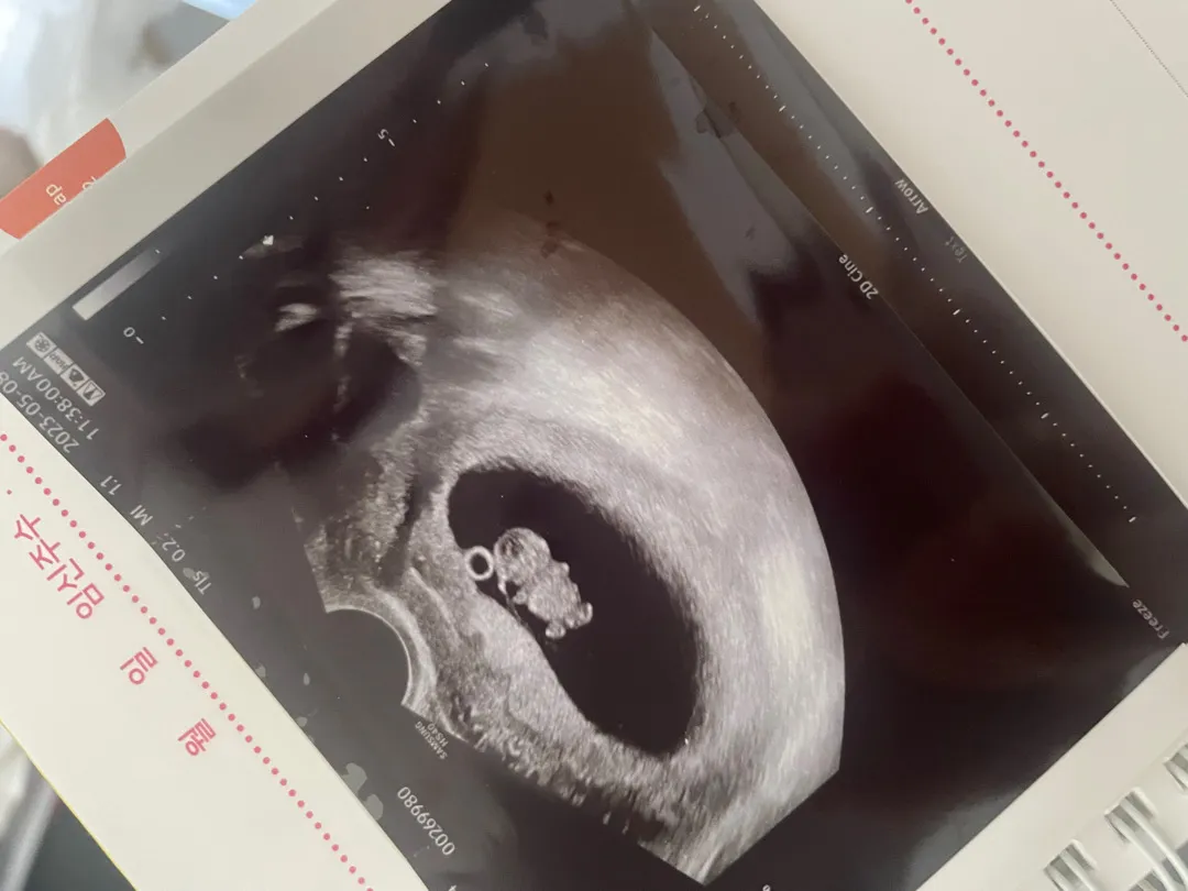 8주6일차 너무귀여웅곰 ㅠㅠ 