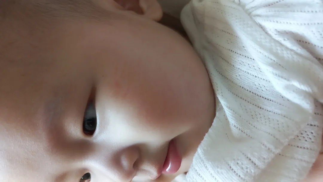 이것도 알러지일까요?