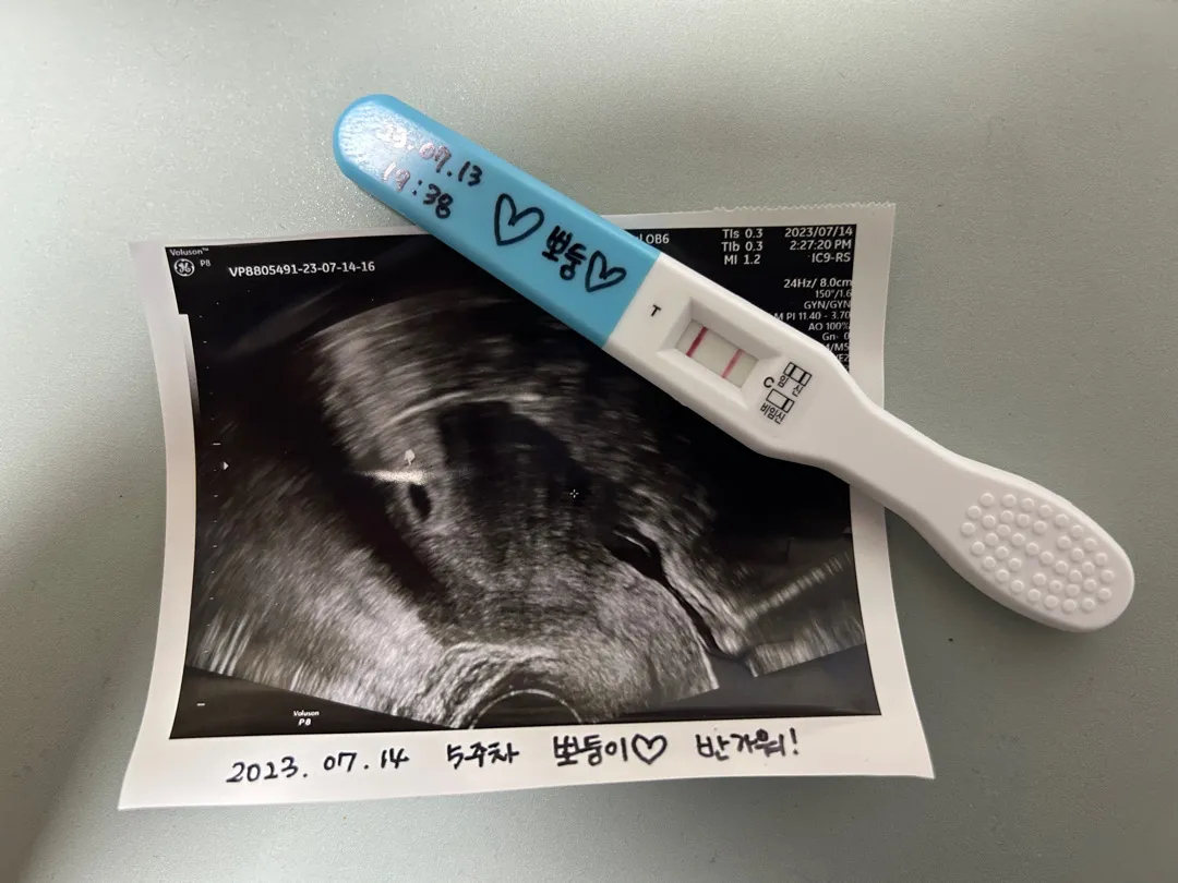 애기집 보고 왔어요ㅠㅠㅠㅠㅠ