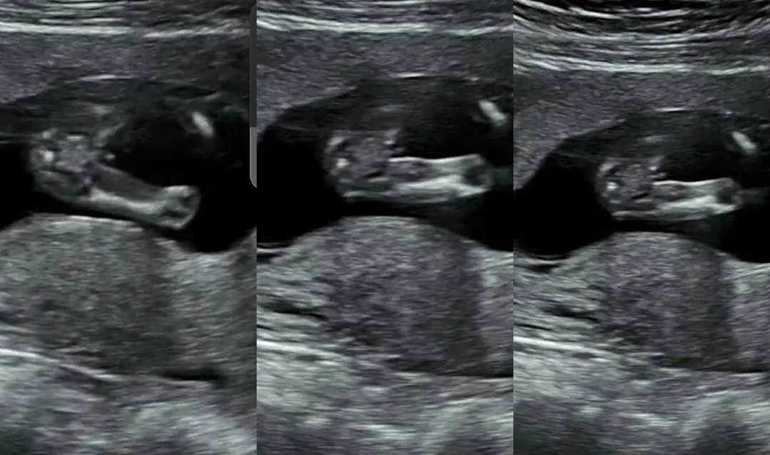 13주6일차 사진이에요 성별확신이 없네요ㅠ