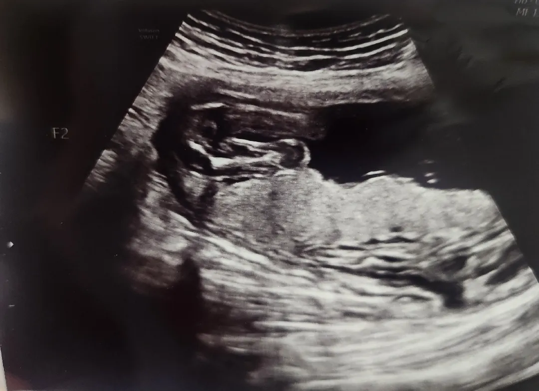 후둥이 성별 궁금해요