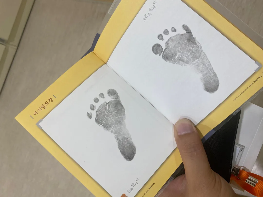 37주 양막파수 응급제왕