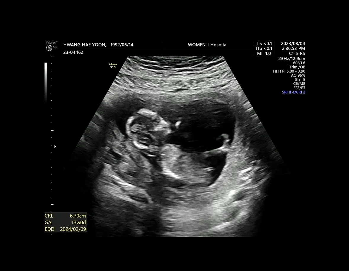 각도법 부탁드려요👶🏻 딸 /아들 ?? 