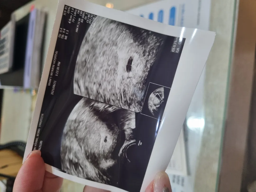 5주차 아기집보구왔어요!!