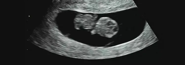 9주 돌입 ! 꼬물거리는거도 봤어요 👼