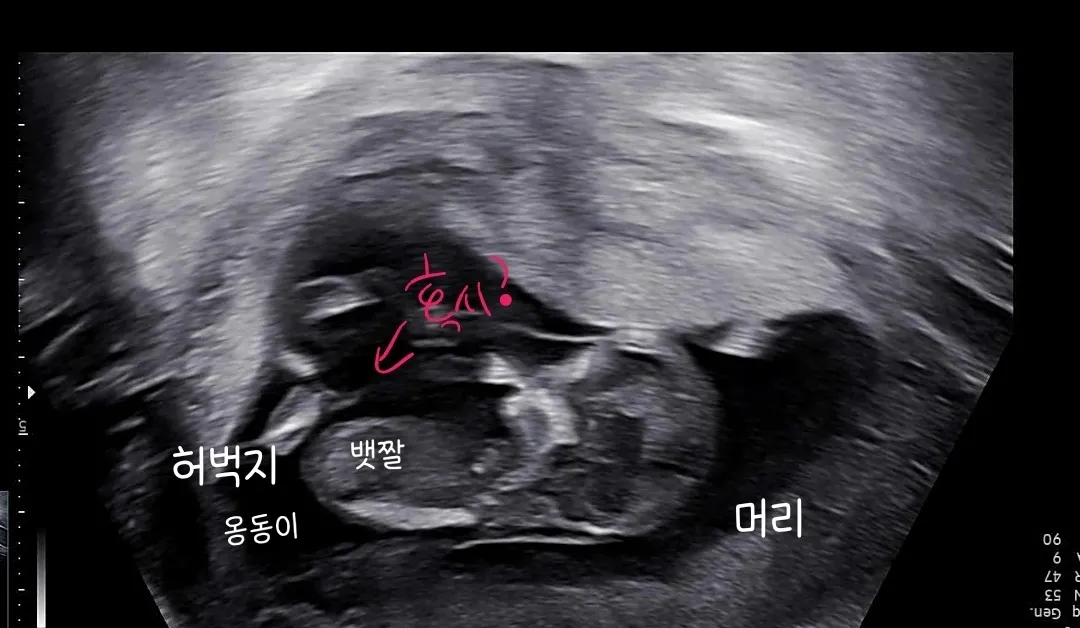 혹시 이게 성기인가요