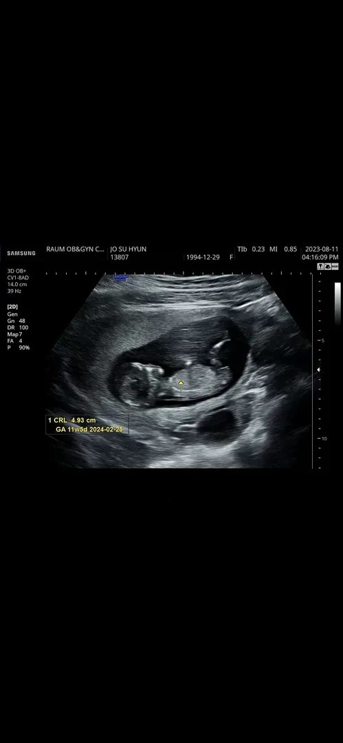 11주3일! 아들일까용?👶🏻
