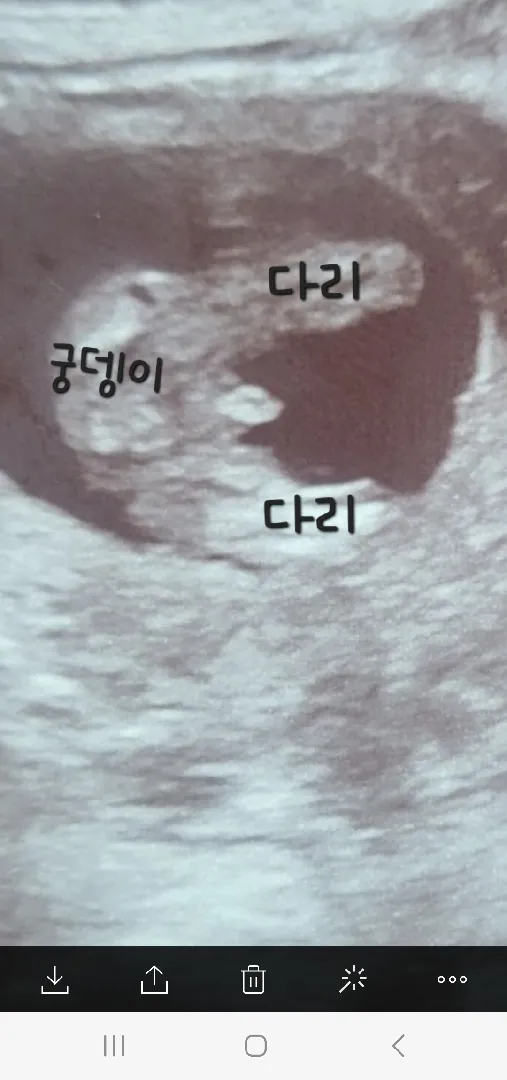 두둥~드뎌 성별보고 와써용