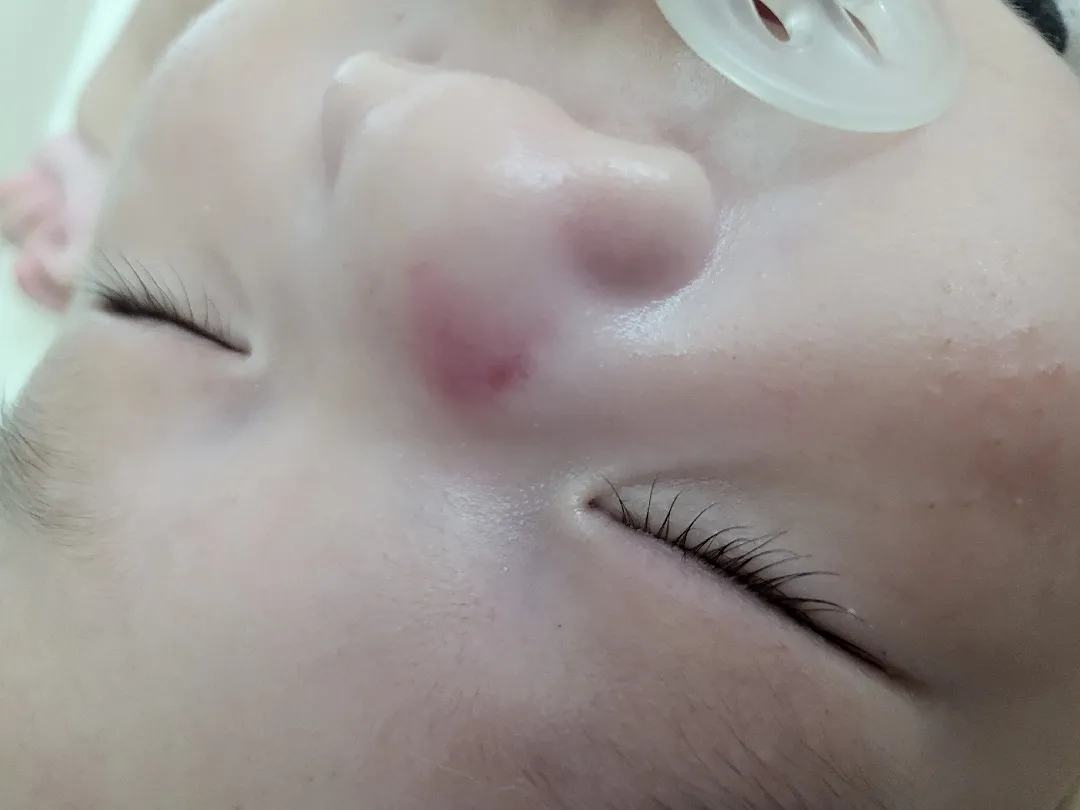 아기코에 폰 떨어졌는데 병원갈지 두고볼지 ㅠ ㅠ( 병원다녀옵)