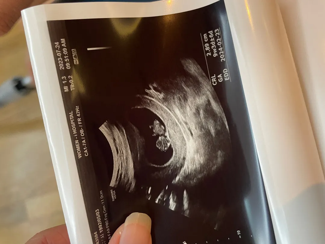 곰젤리 보고왔어요 🧸(9w3d)