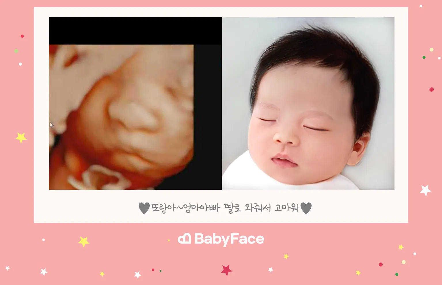 베이비페이스 고민했는데 하니 넘 좋네요^^