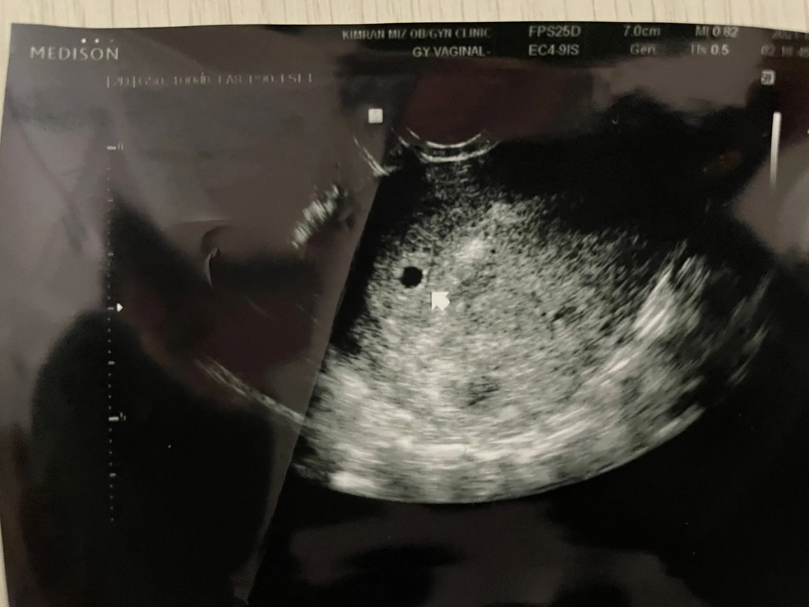 21일에 첫 아기집 보구왔어요^^