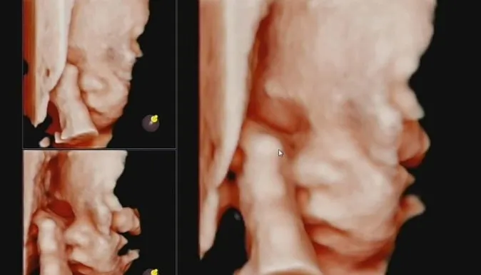 community post image