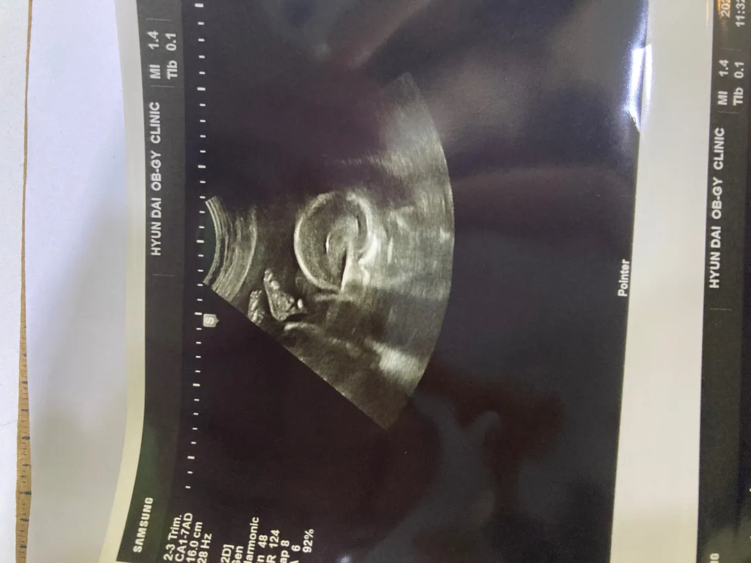 community post image