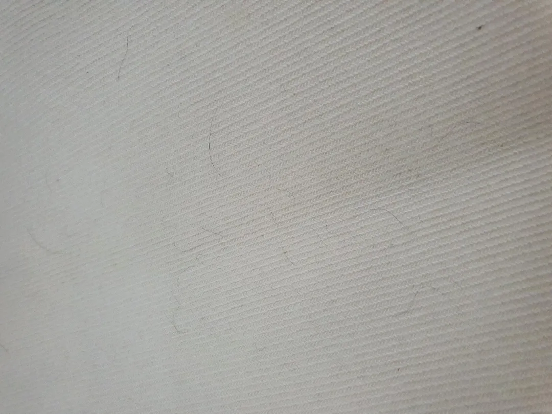 아기 머리카락 빠짐