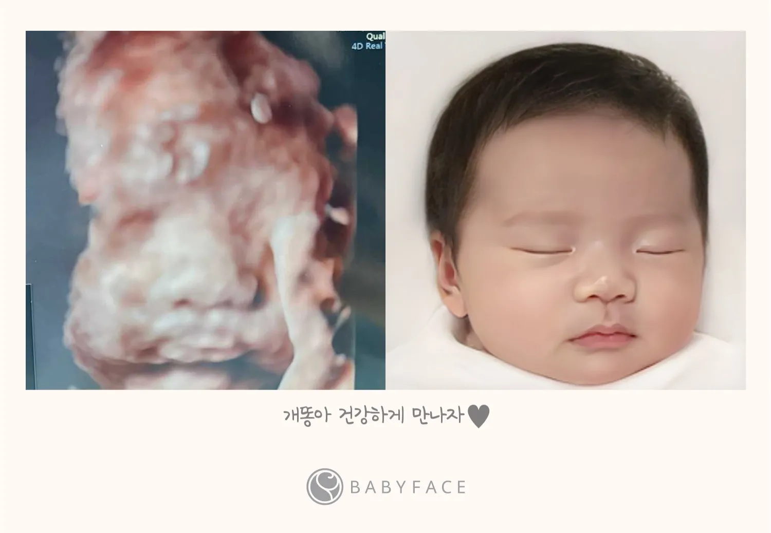드디어 아기 얼굴 보고왔어요!!!!