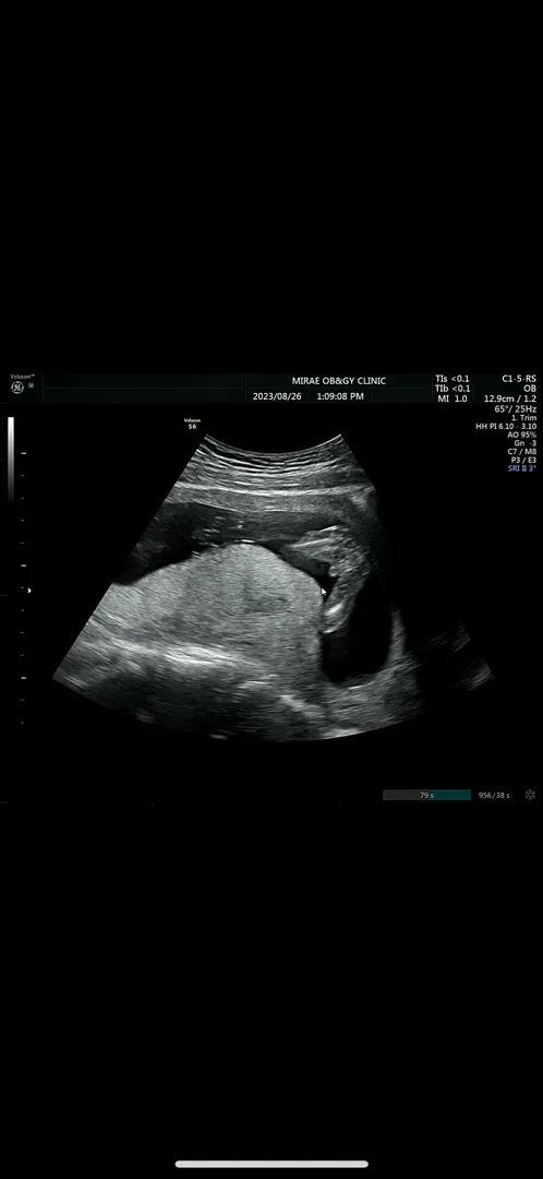 16주1일인데 성별전환 없겠죠..?무조건 남자 아이 겠죠 이거는...?ㅋㅋ