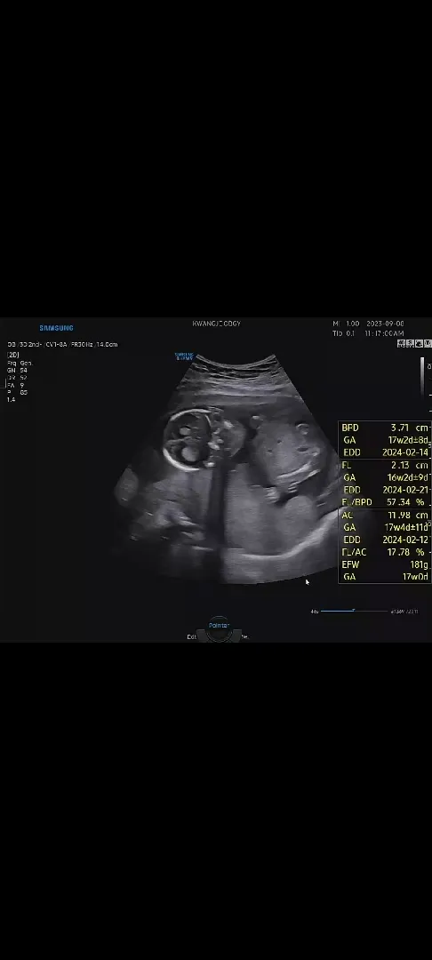 16주3일 성별 궁금