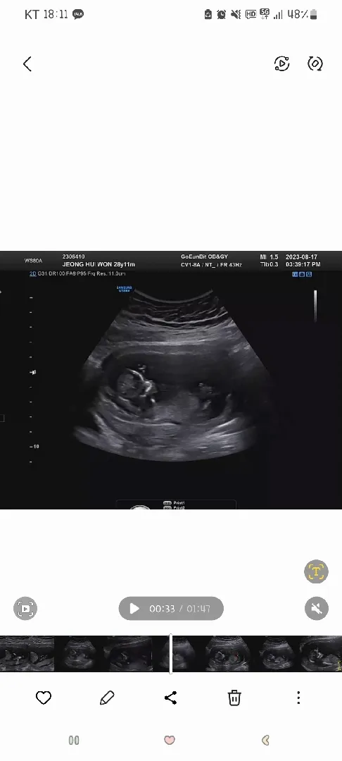 딸같다는데 맞을까용??