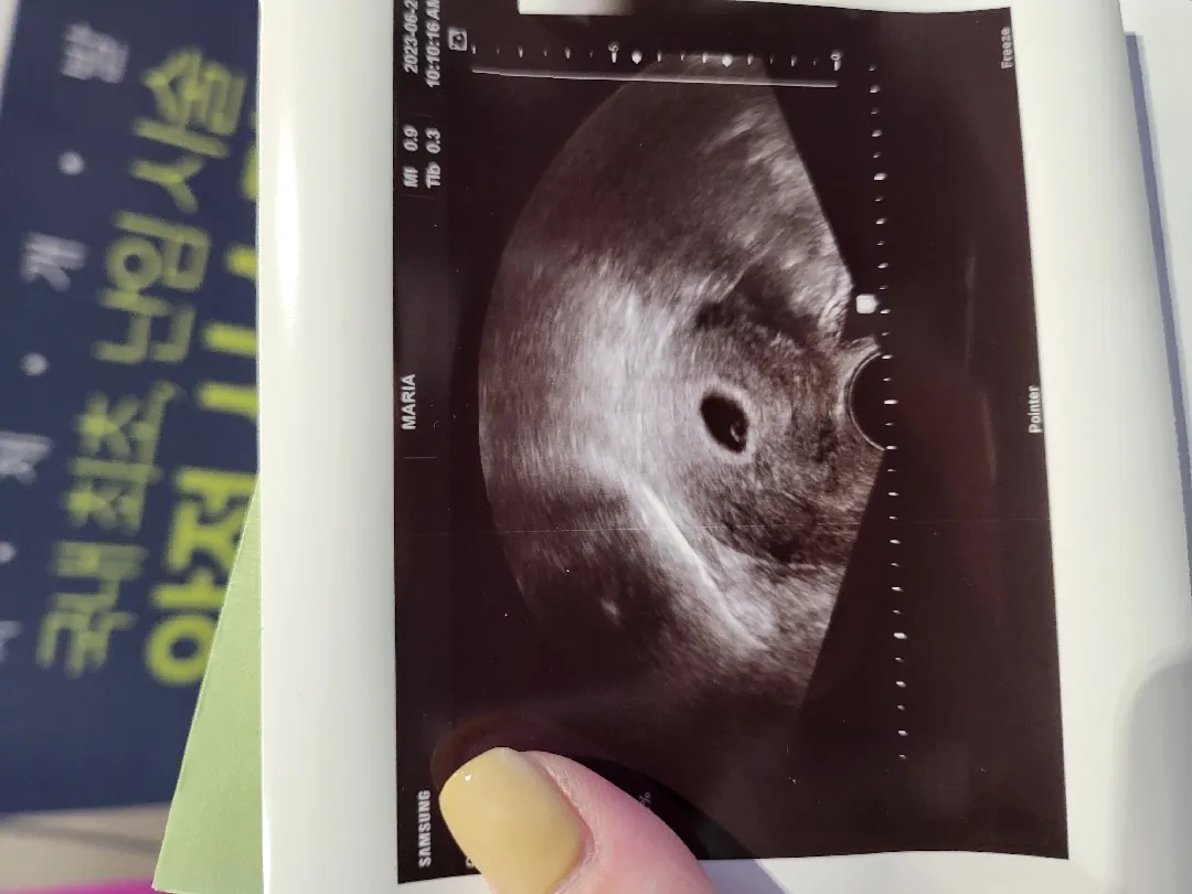 시험관으로 찾아온튼강이
