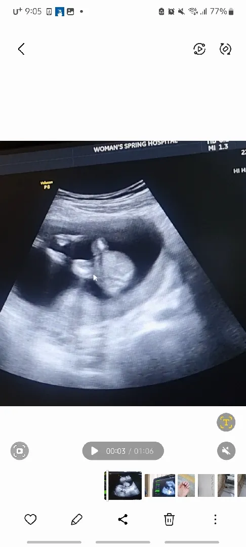14주5일차인데..  딸일까요??